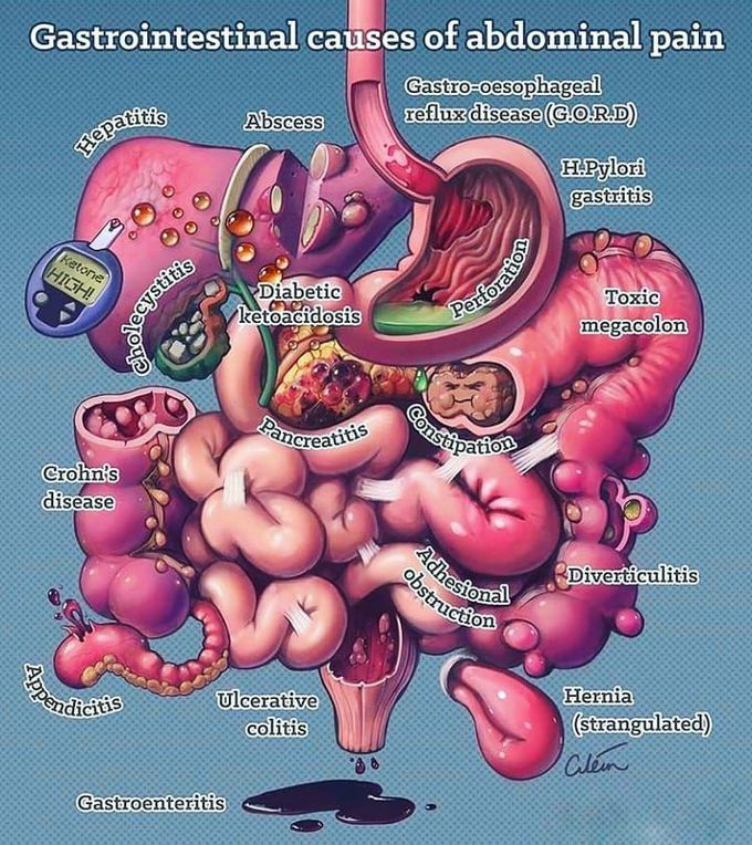 Gastric abdominal pain