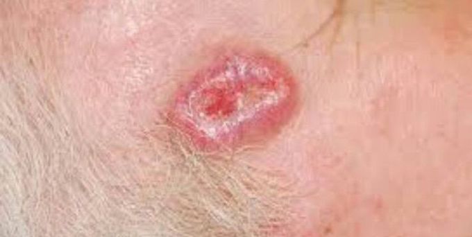 Diagnosis please 🙂