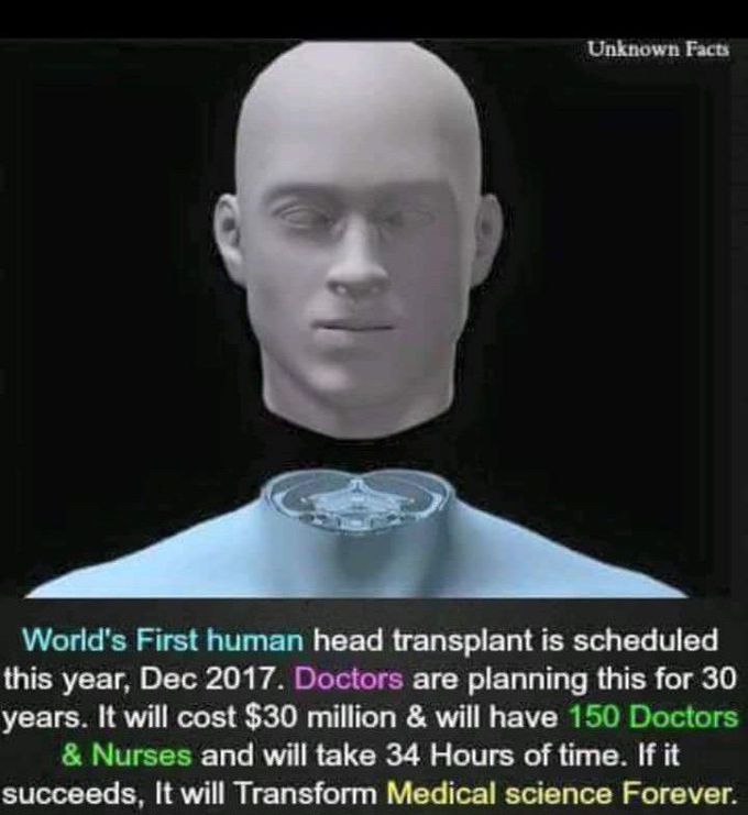 Head transplant