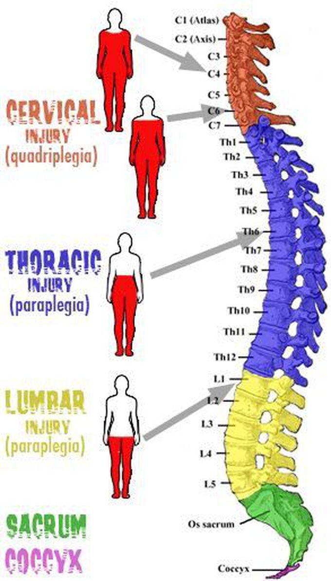 Spinal cord injury nd its affected areas of body