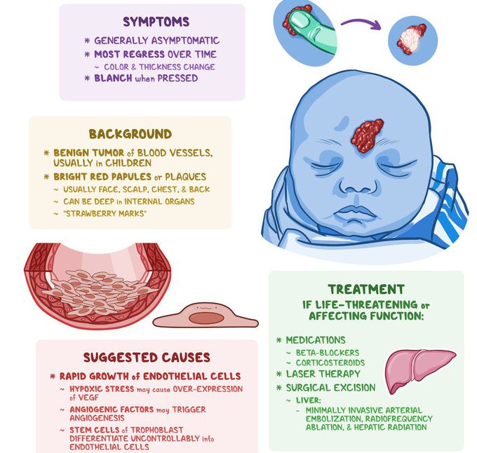 Heamangioma - MEDizzy