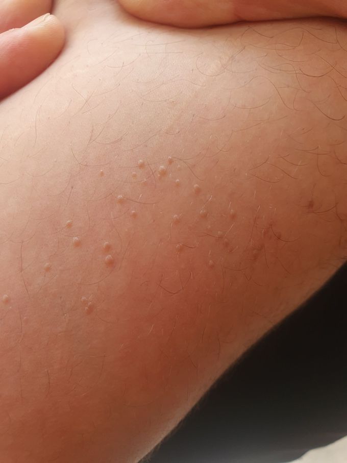 Hello  friends , Could  anyone help in diagnosis