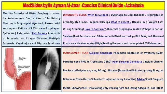 Achalasia