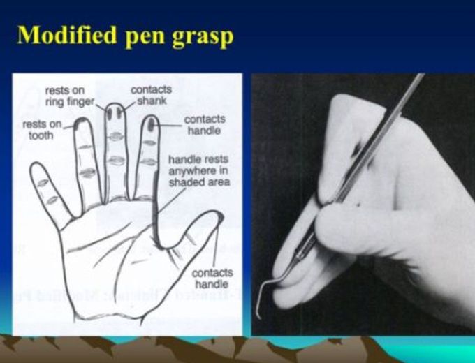 Modified Pen Grasp Method
