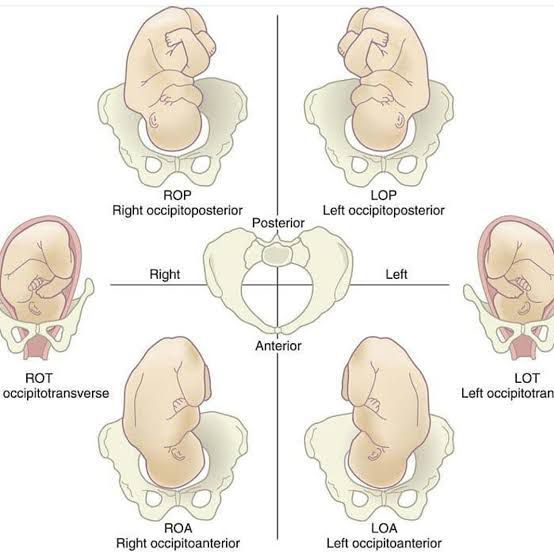 Position of Fetus - MEDizzy