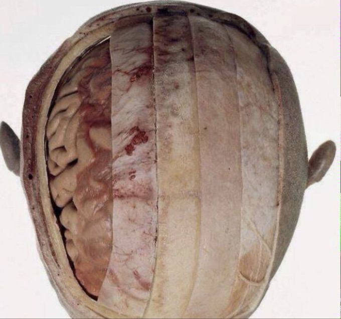 layers of the scalp😍