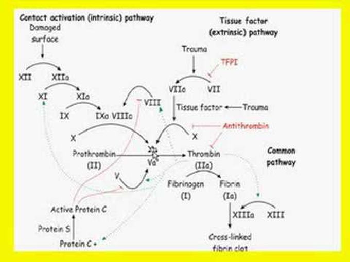Chapter 4g: Hemodynamic Disorders, Thromboembolic Disease, and Shock (THROMBOSIS)