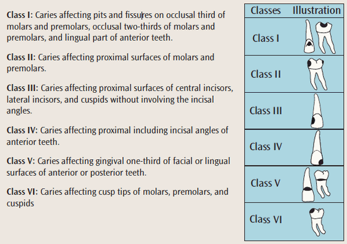 Gv black classification