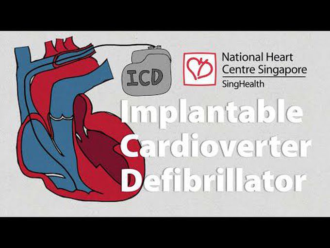 Implantable Cardioverter Defibrillator-
Introduction
