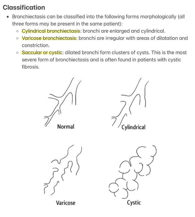 Bronchiectasis II