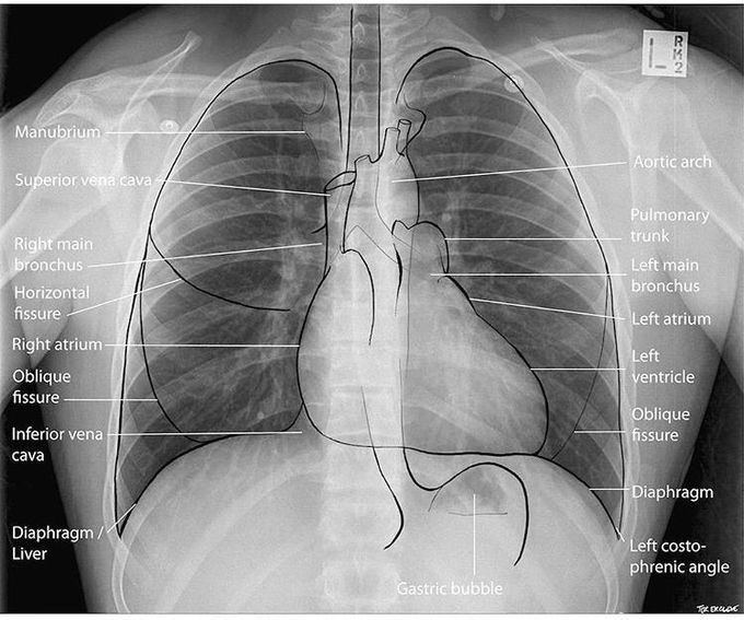 X-ray - MEDizzy