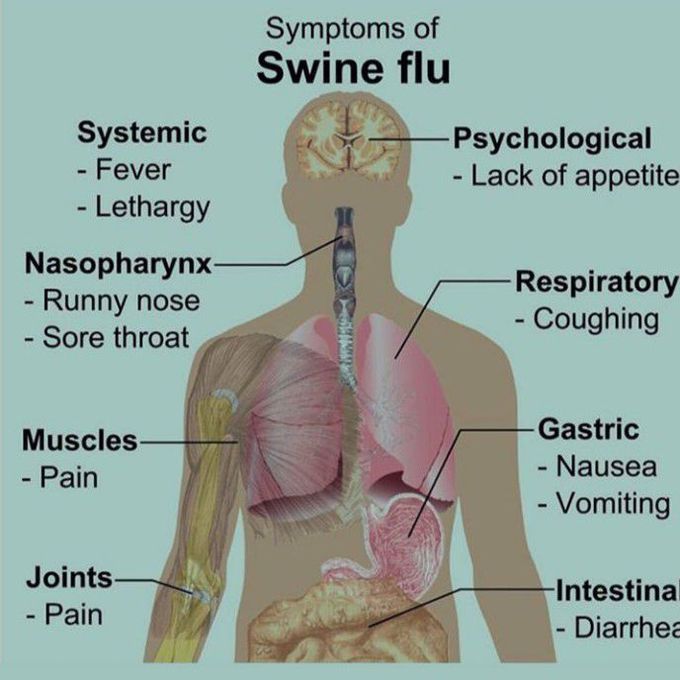 Swine flu