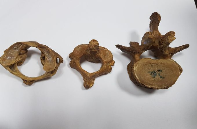 Human vertebra