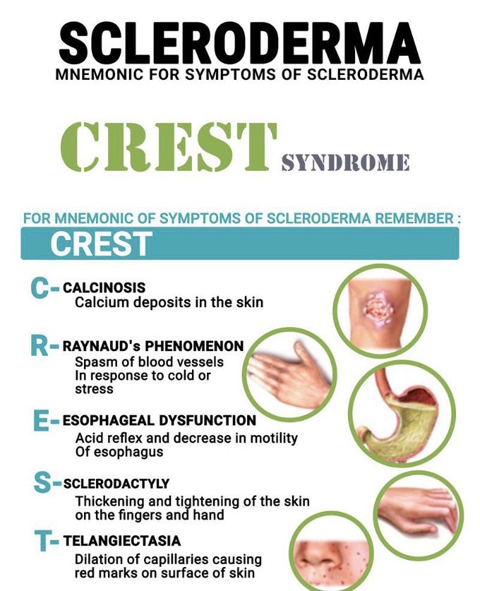 SCLERODERMA (CREST)