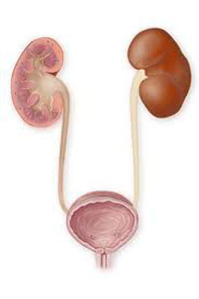 Kidney failure