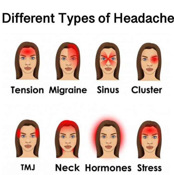 Different types of headache