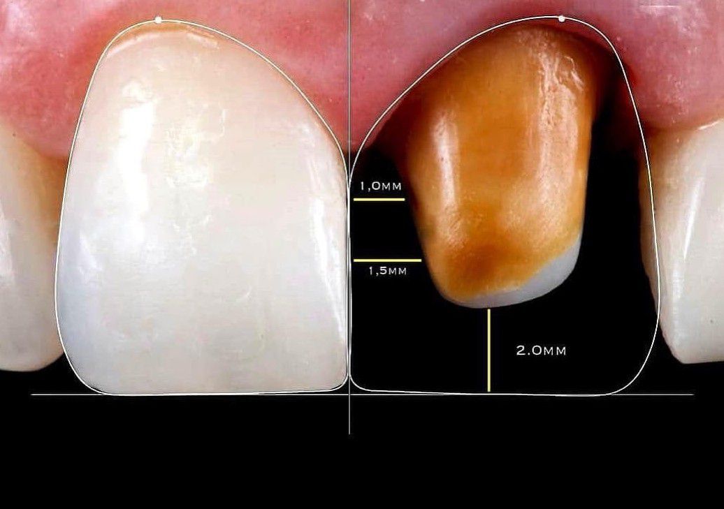 Dimensional Consistency MEDizzy