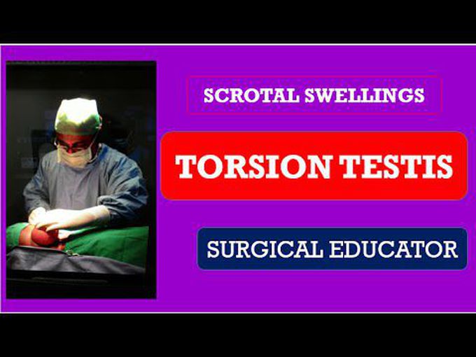 Testicular Torsion