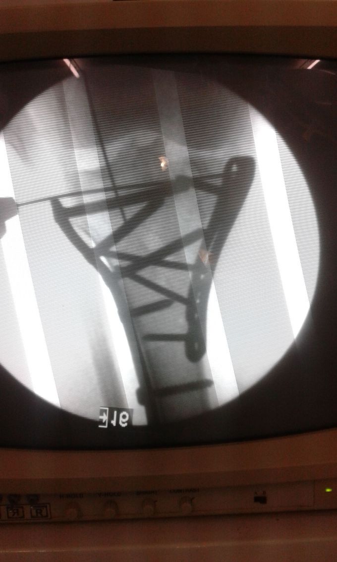 Ortho