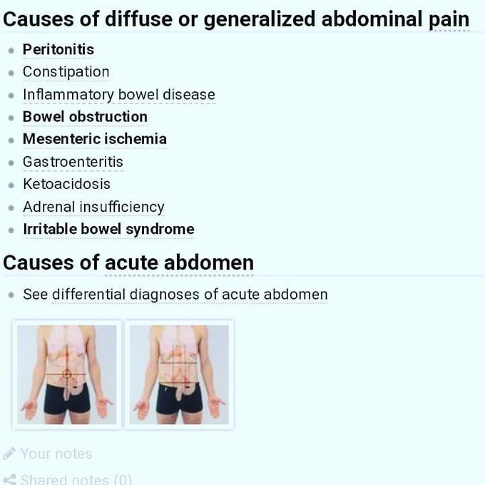 Causes of abdomen pain