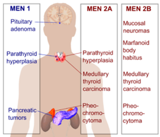 Multiple endocrine neoplasia