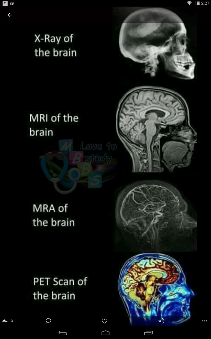 Differents