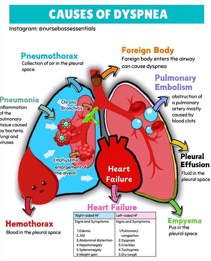 Causes of Dyspnea