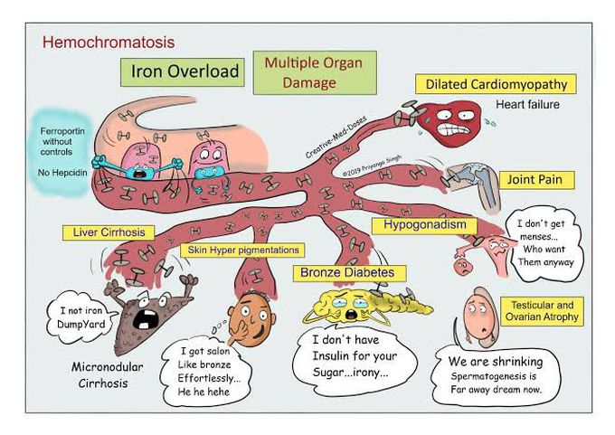 Hemochromatosis