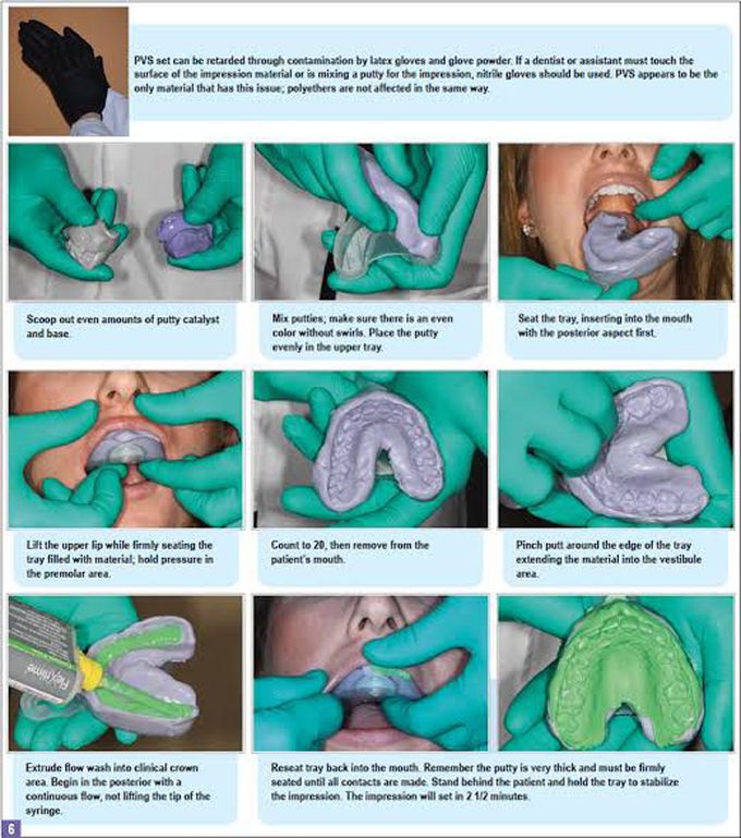 Impression taking techniques