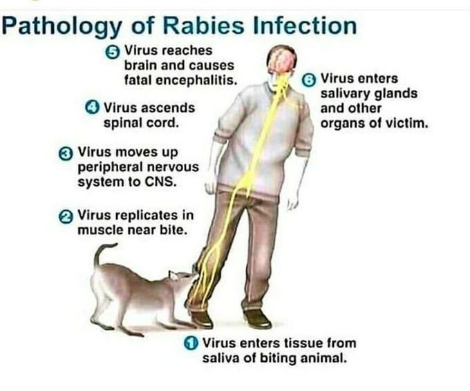 Pathology of rabies infection