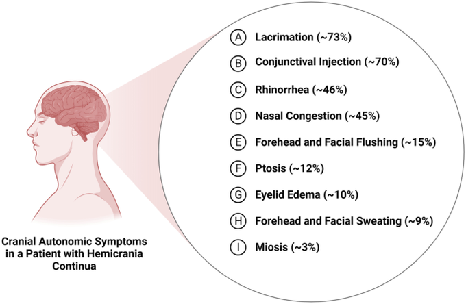 Symptoms of hemicrania continua