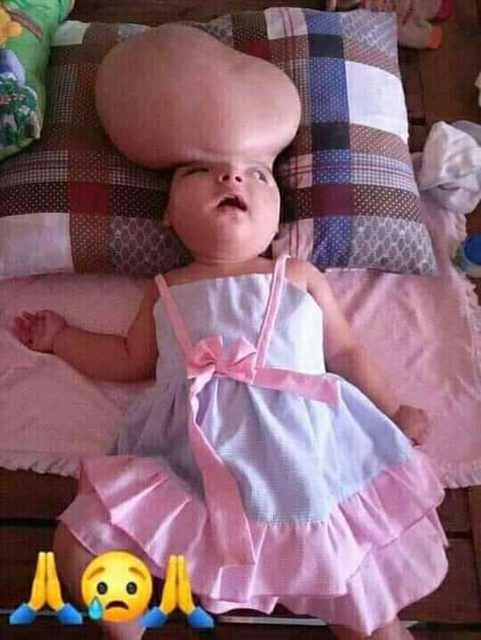 Please what kind of treatment??!