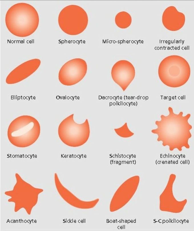 Normal vs abnormal