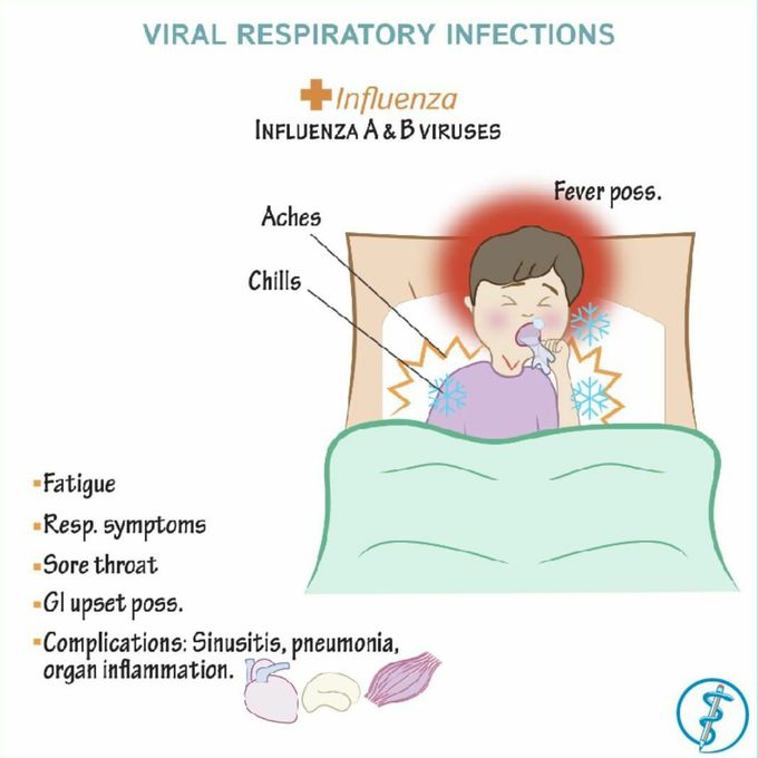 Viral  respiratory infection