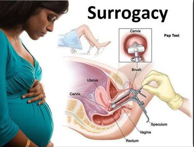 Surrogacy