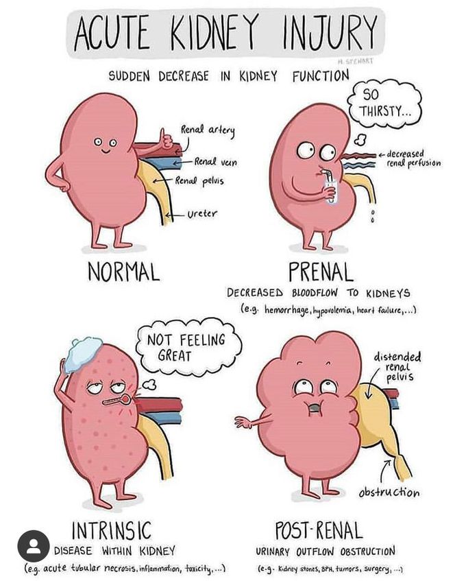 Kidney injury