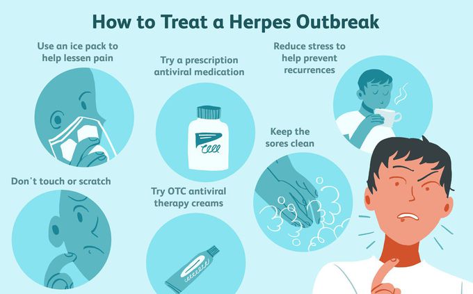 Treatment for Herpes simplex virus