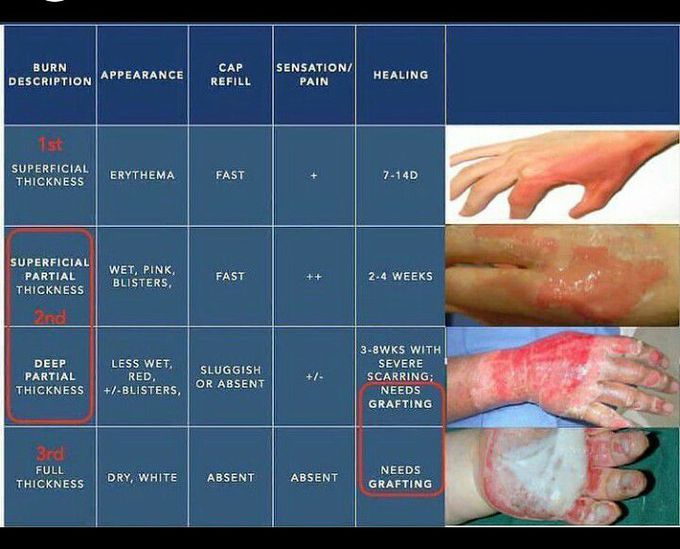 Rug burn” of an elderly woman - MEDizzy