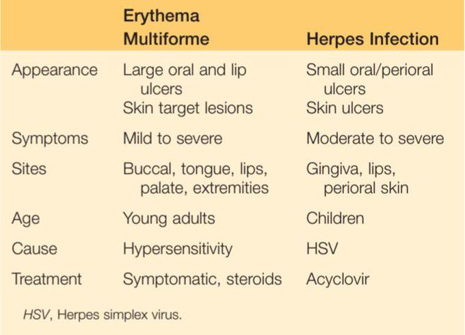 Erythma multiforme vs Herpes infection