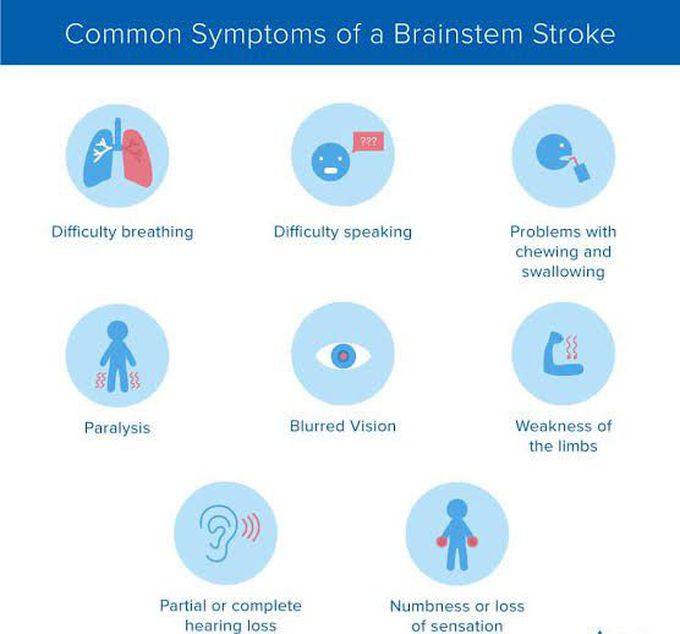 These are the symptoms of Brainstem stroke syndrome