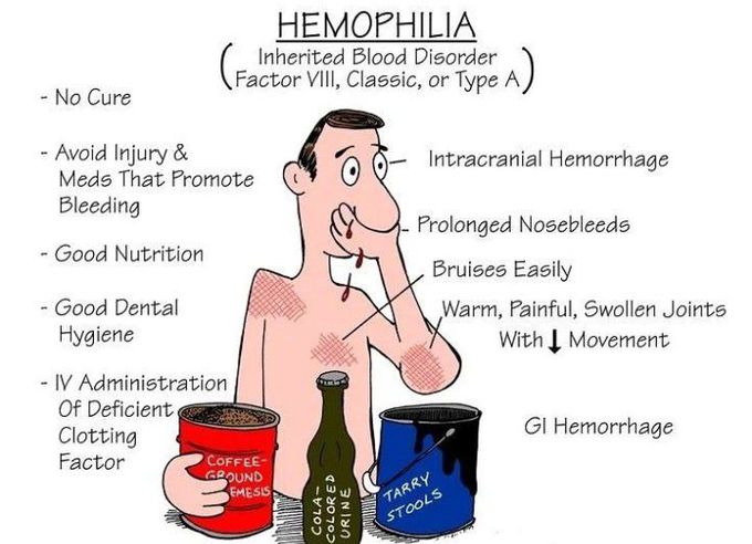 Hemophilia