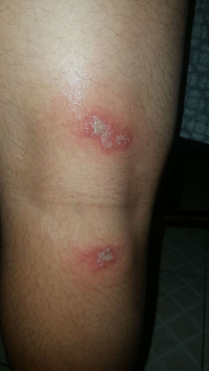 What's your diagnosis ?