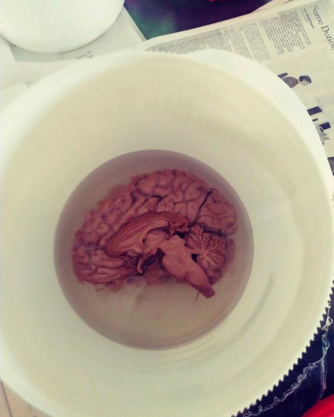 human brain real cut