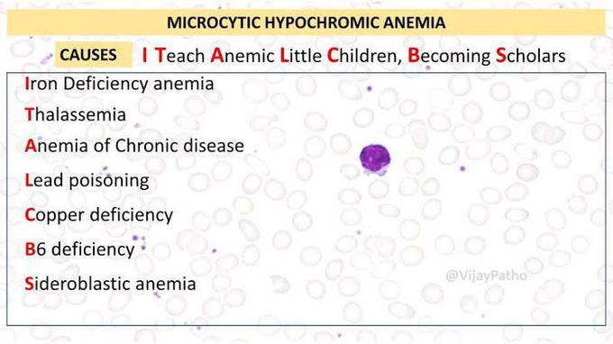 Microcytic Hypochromic Anemia