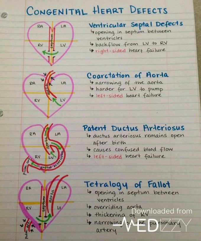 Disease of heart