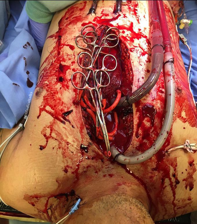 Medical case