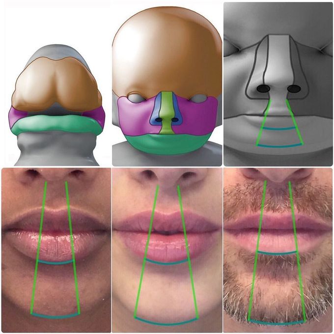 Understanding Embryology and re-shaping the lips