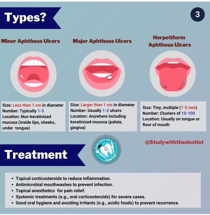 Aphthous Ulcers II