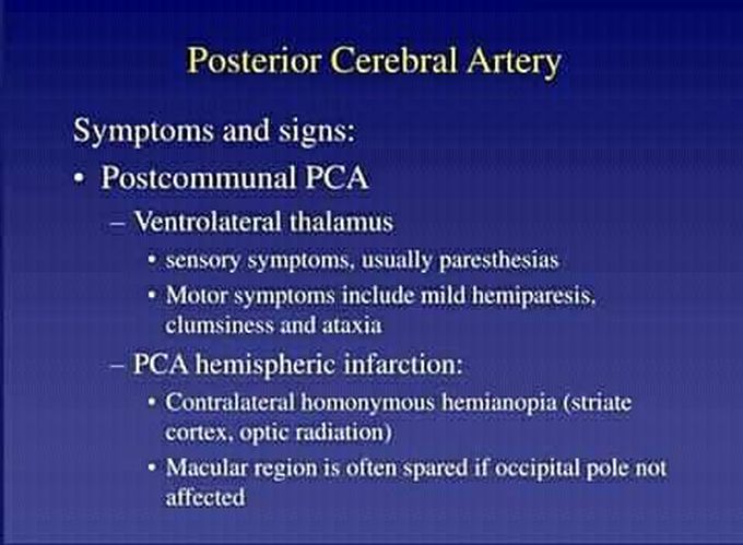 These are the symptoms and signs of Posterior Cerebral artery syndrome