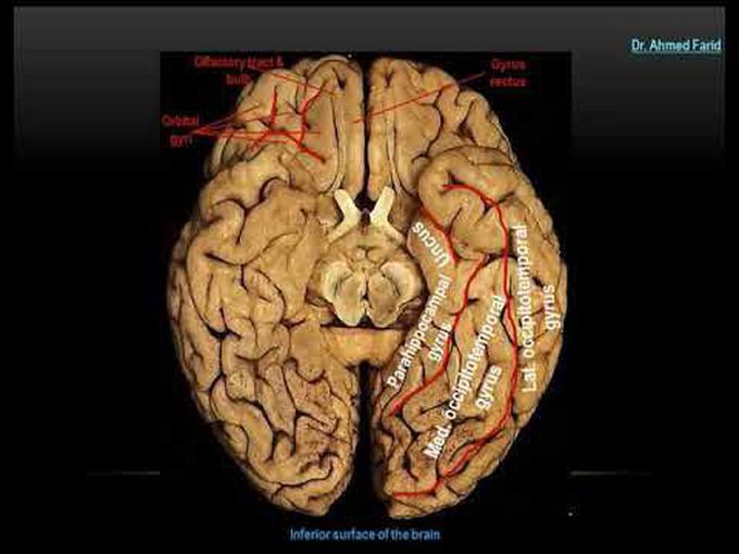 Inferior Surface of Cerebral Hemisphere: A Tutorial